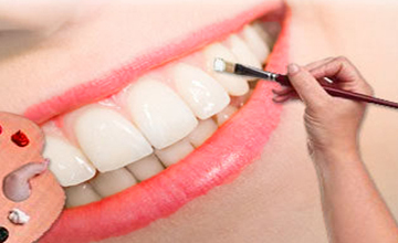 Synder Smiles Cosmetic Dentistry service